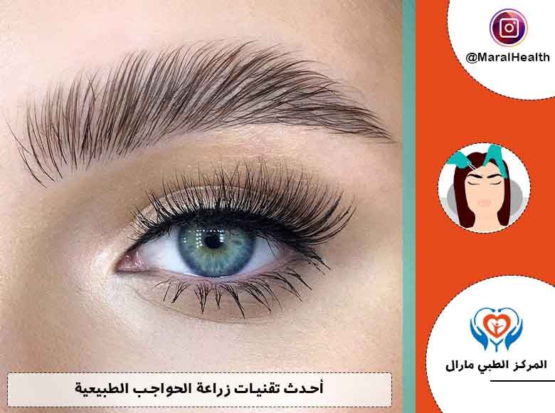 أحدث تقنيات زراعة الحواجب الطبيعية