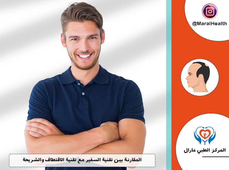 الفرق بين تقنية السفير و FUE,FUT
