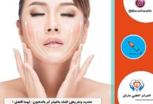 تحديد وتعريض الفك بالفيلر أم بالدهون