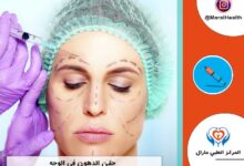 حقن الدهون في الوجه | المرکز الطبي مارال