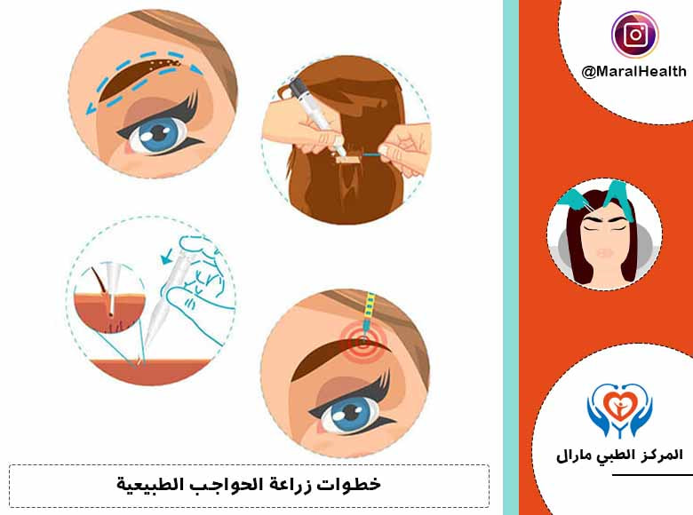 خطوات زراعة الحواجب الطبيعية