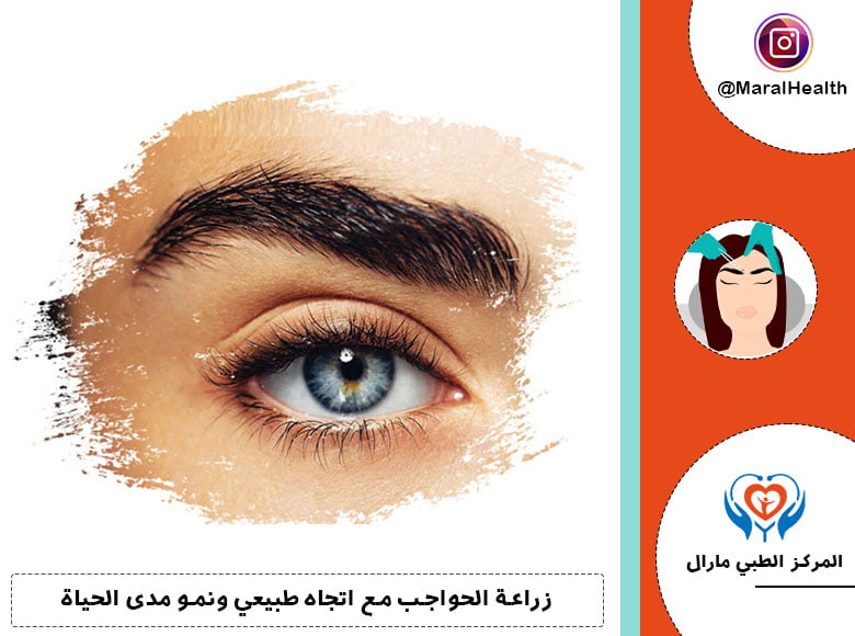 زراعة الحواجب | المرکز الطبي مارال