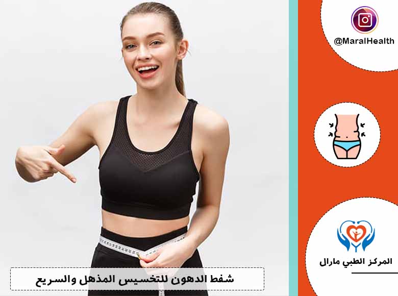 شفط الدهون | المرکز الطبي مارال | 2023