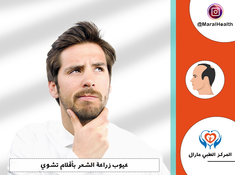 عيوب زراعة الشعر بأقلام تشوي