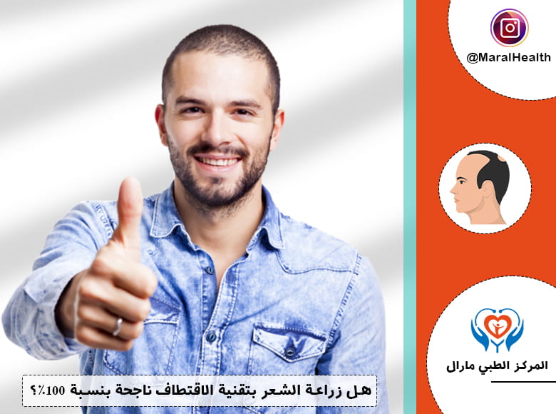 هل زراعة الشعر بتقنية الاقتطاف ناجحة