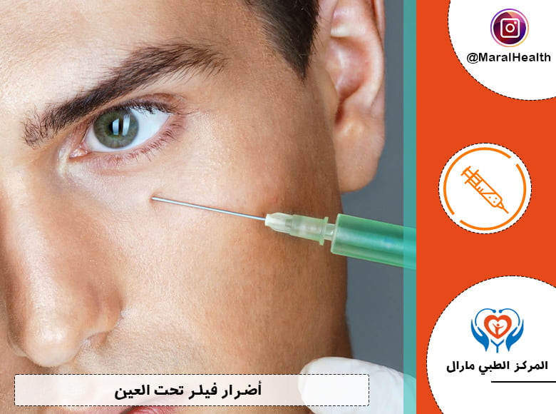 أضرار فيلر تحت العين