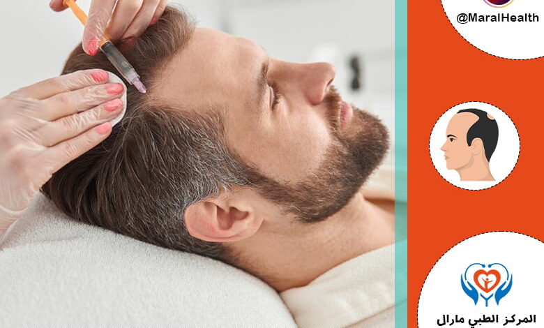 الميزوثيرابي للشعر | المرکز الطبي مارال