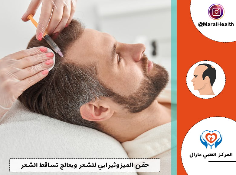 الميزوثيرابي للشعر | المرکز الطبي مارال