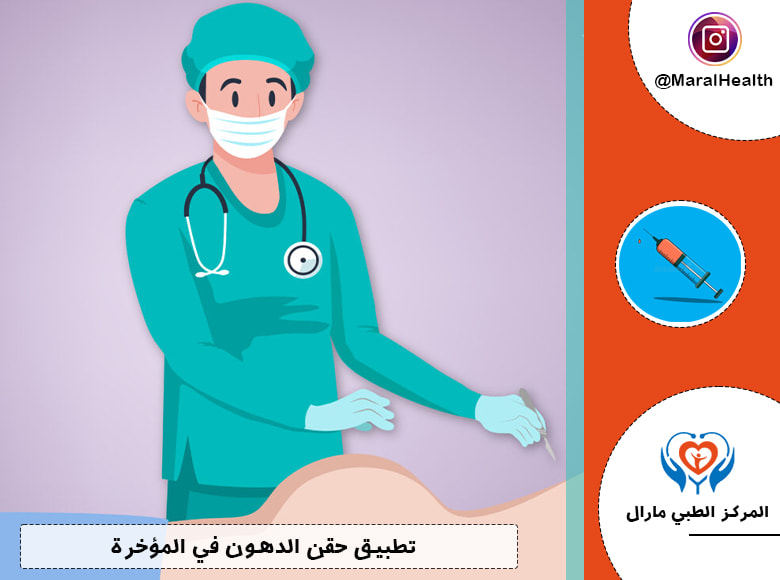 تطبيق حقن الدهون في المؤخرة