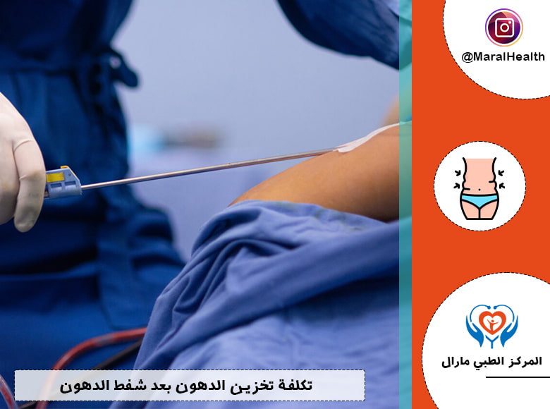 تكلفة تخزين الدهون بعد شفط الدهون