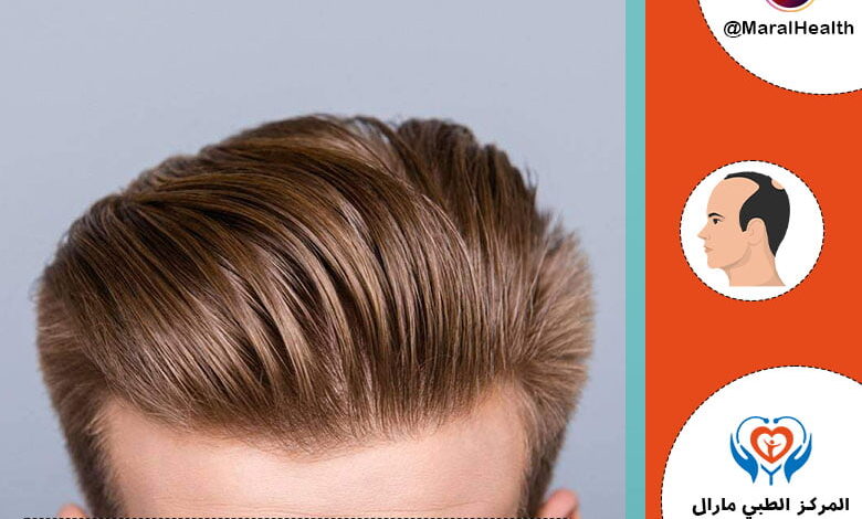زراعة الشعر في مقدمة الرأس 2023 | المرکز الطبي مارال
