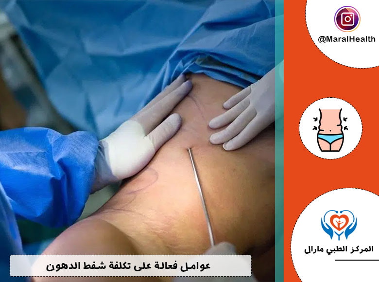عوامل فعالة على تكلفة شفط الدهون
