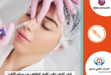 فيلر الانف | المرکز الطبي مارال 2023