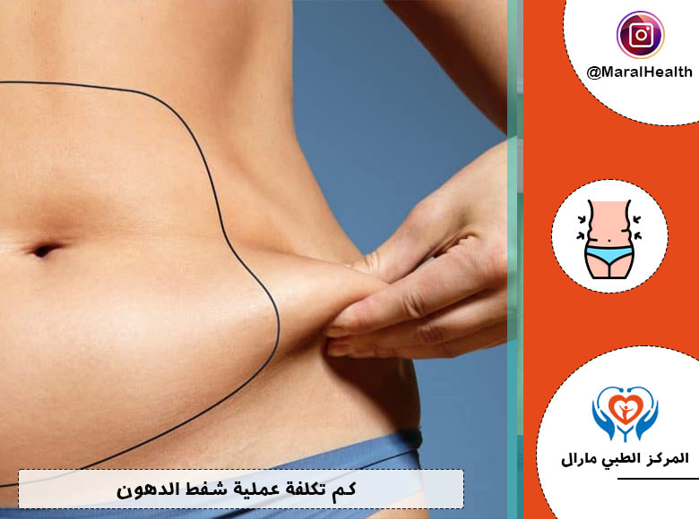 كم تكلفة عملية شفط الدهون | المرکز الطبي مارال | 2023
