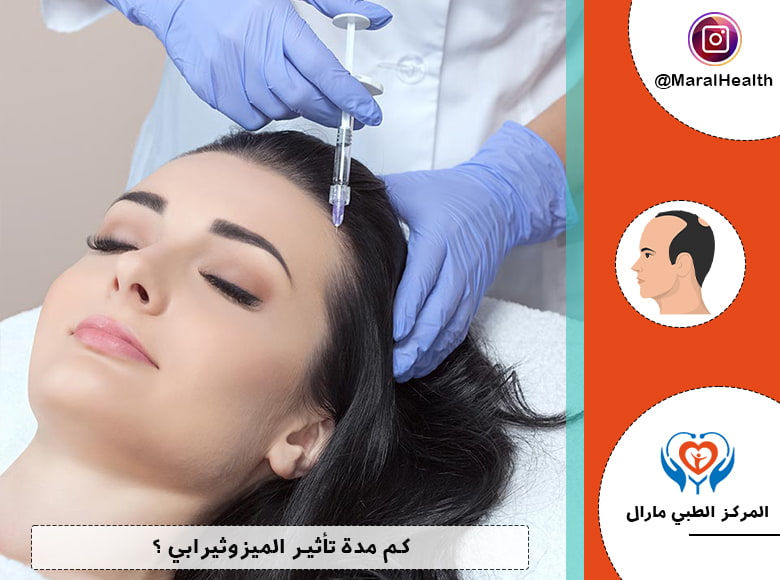 كم مدة تأثير الميزوثيرابي ؟