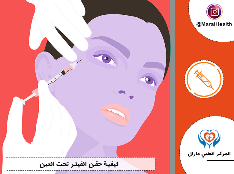 كيفية حقن الفيلر تحت العين