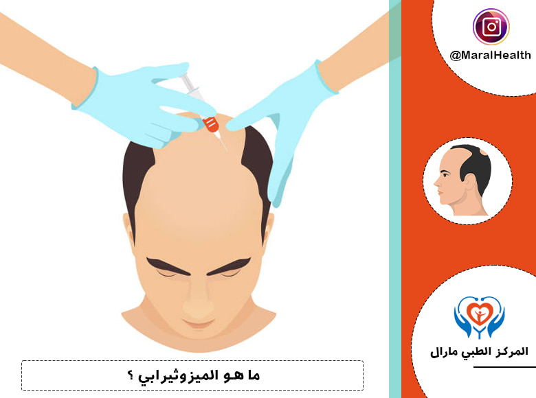ما هو الميزوثيرابي ؟