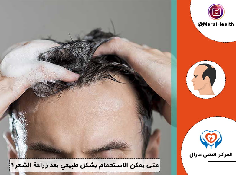 متى يمكن الاستحمام بشكل طبيعي بعد زراعة الشعر؟