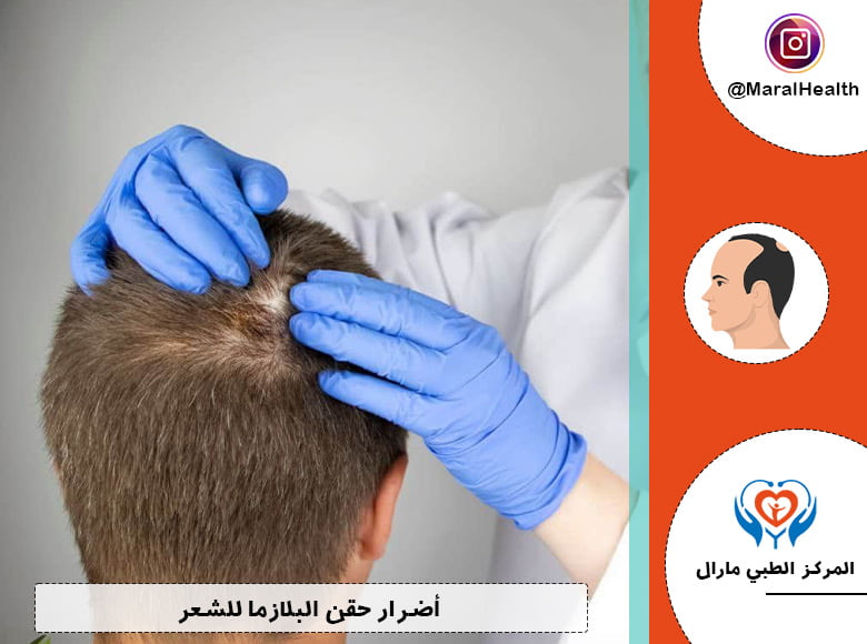 أضرار حقن البلازما للشعر