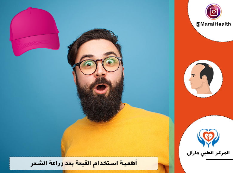 أهمية استخدام القبعة بعد زراعة الشعر