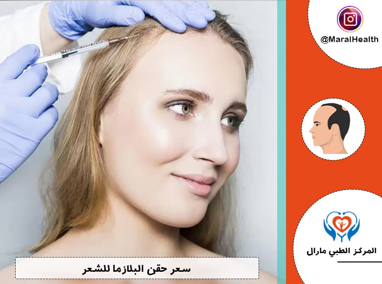 سعر حقن البلازما للشعر