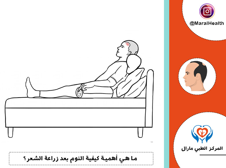 ما هي أهمية كيفية النوم بعد زراعة الشعر؟