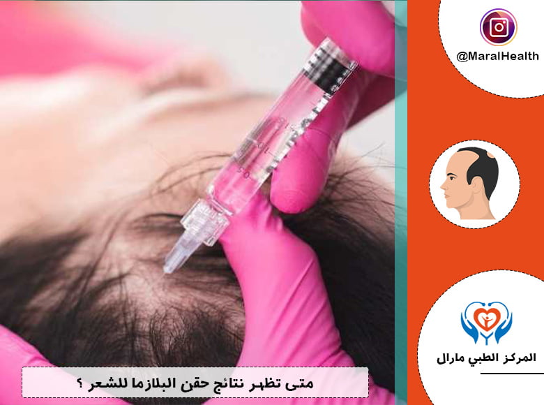 متى تظهر نتائج حقن البلازما للشعر ؟