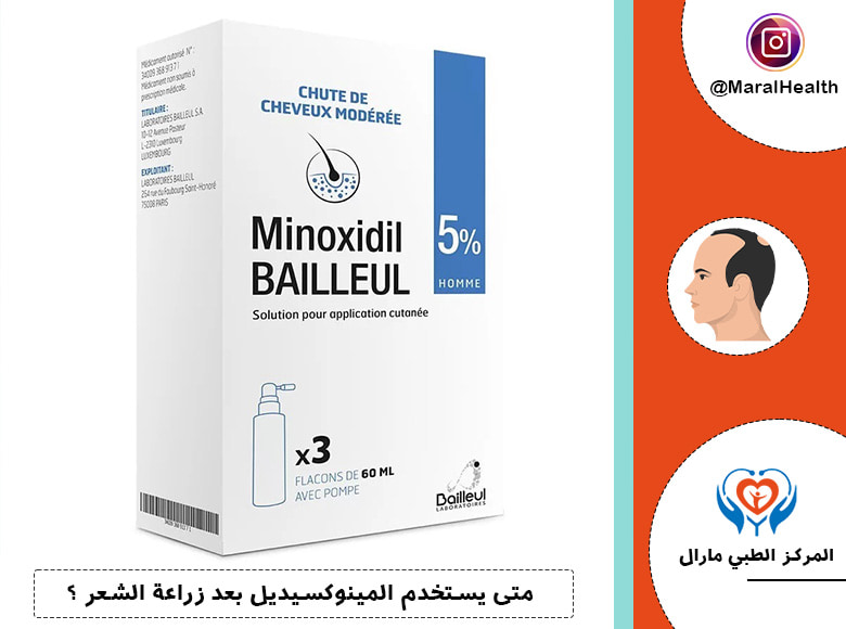 متى يستخدم المينوكسيديل بعد زراعة الشعر ؟