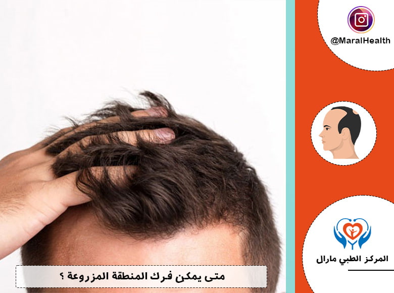 متى يمكن فرك المنطقة المزروعة ؟
