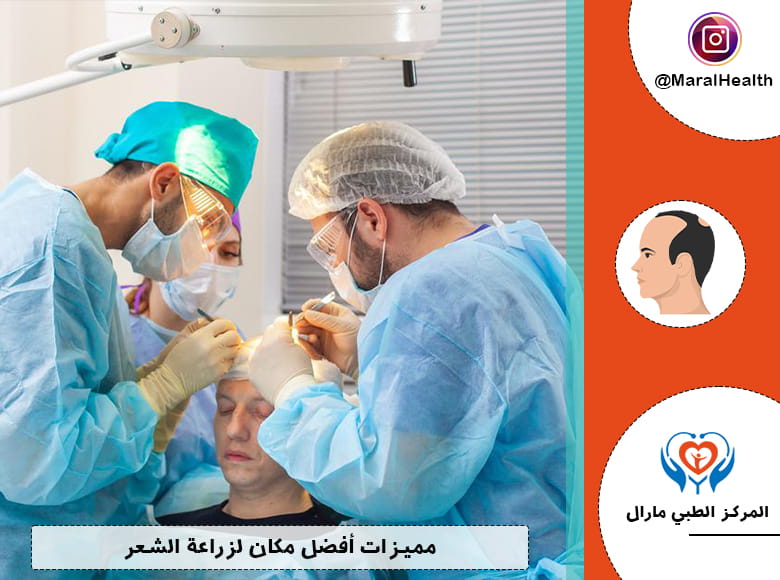 مميزات أفضل مكان لزراعة الشعر