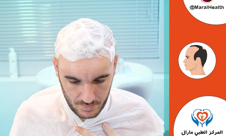 العناية ودليل ما بعد زراعة الشعر - المرکز الطبي مارال