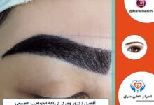 أفضل دكتور زراعة الحواجب 2023 | المرکز الطبي مارال