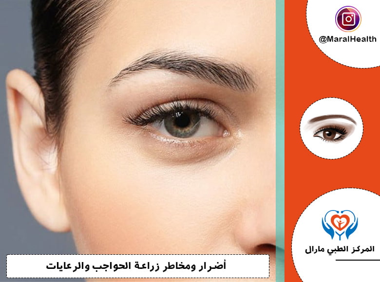 أضرار ومخاطر زراعة الحواجب والرعايات