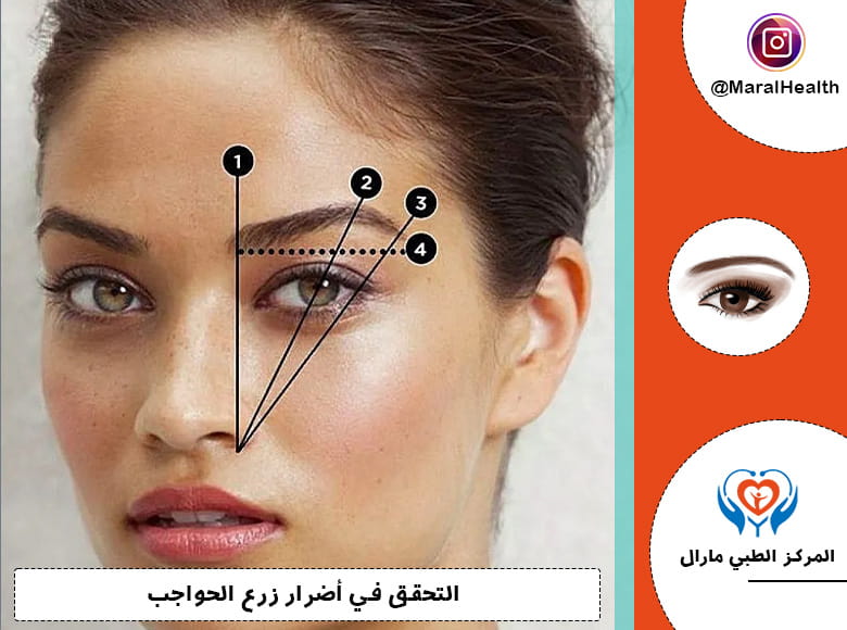 التحقق في أضرار زرع الحواجب