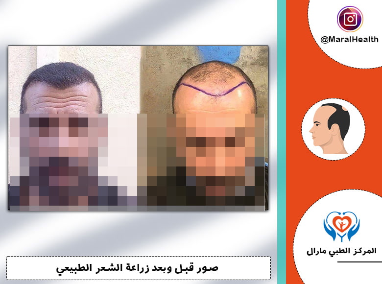 تقنية السفير