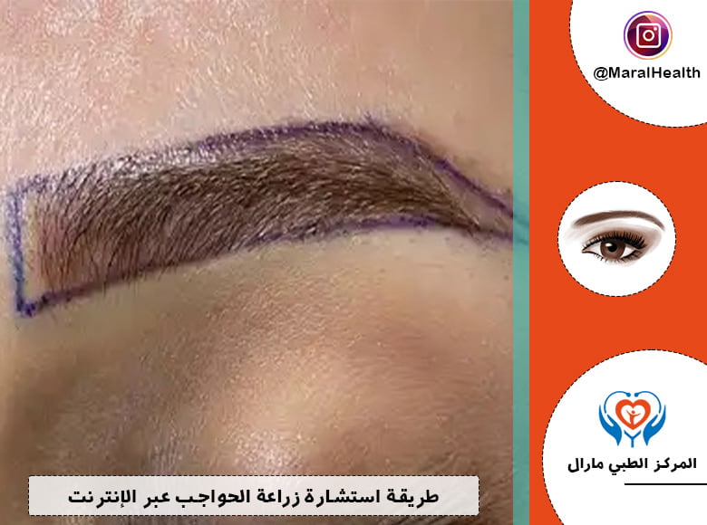 طريقة استشارة زراعة الحواجب عبر الإنترنت