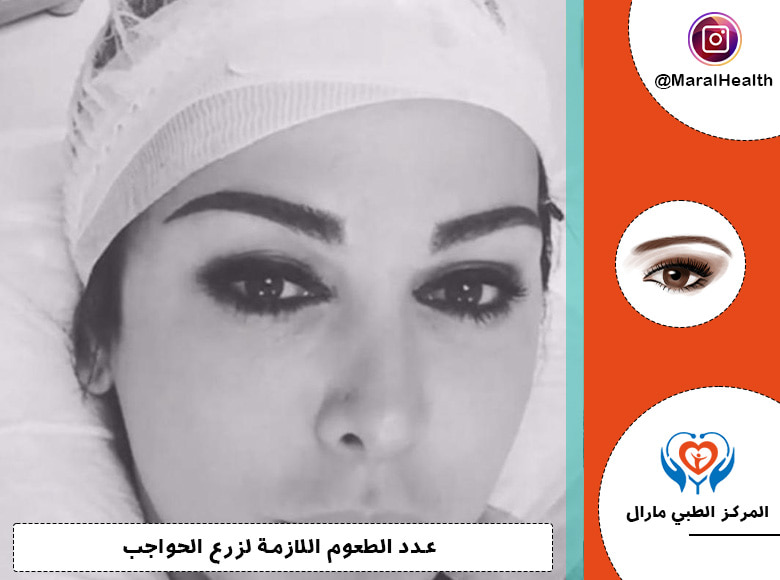 عدد الطعوم اللازمة لزرع الحواجب