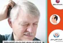 فروة الرأس وإدخال أنواع وأسباب التهابها وعلاجها