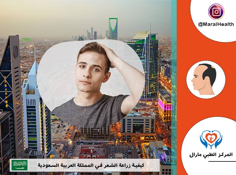 كيفية زراعة الشعر في المملكة العربية السعودية
