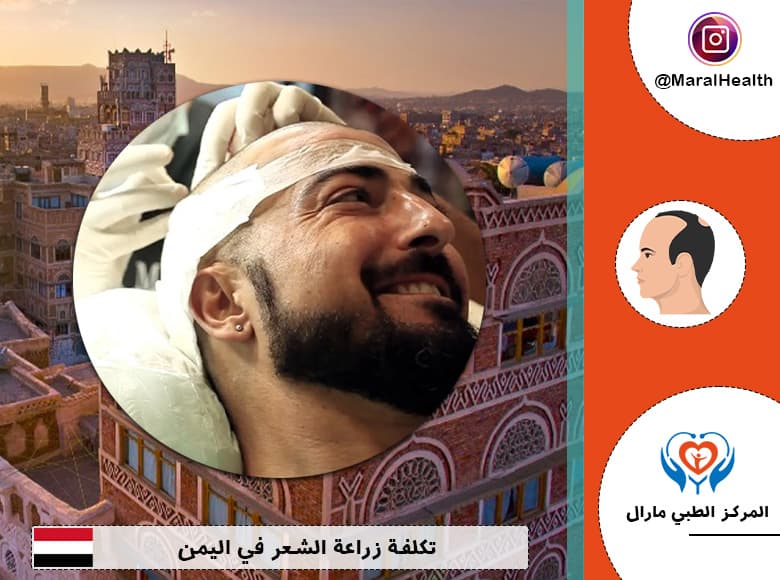 تكلفة زراعة الشعر في اليمن 2023