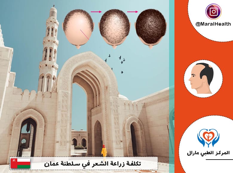 تكلفة زراعة الشعر في عمان