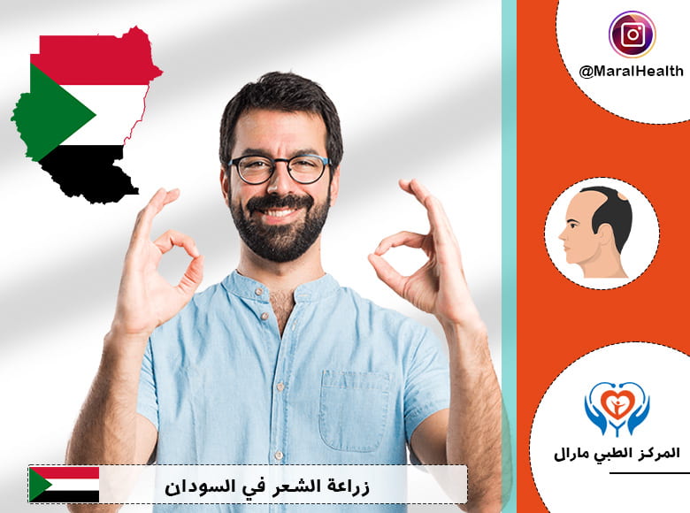 زراعة الشعر في السودان
