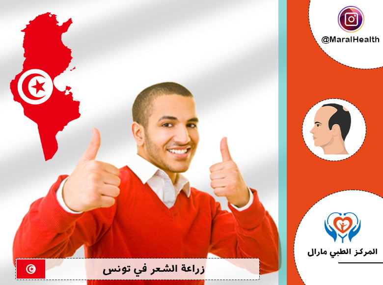 زراعة الشعر في تونس