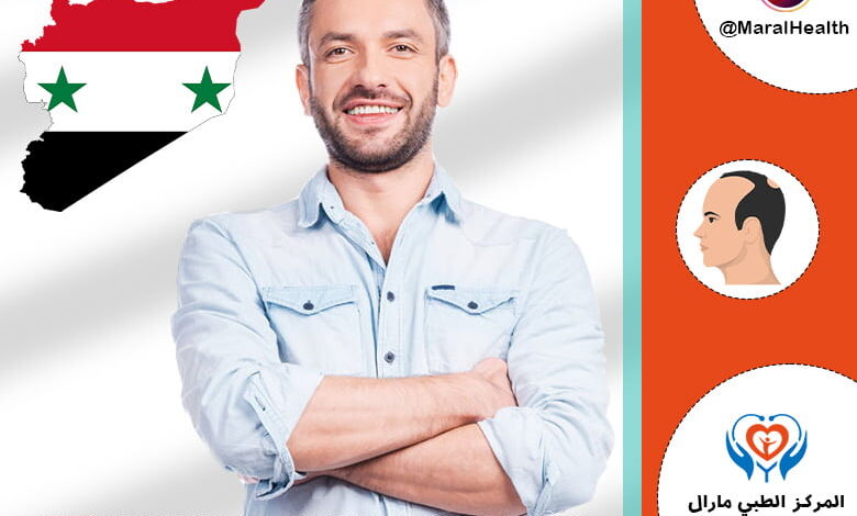 زراعة الشعر في سوريا