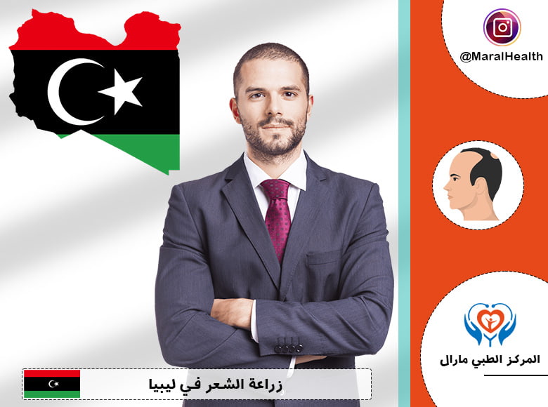 زراعة الشعر في ليبيا