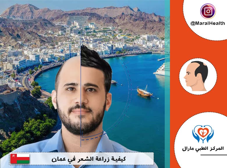 كيفية زراعة الشعر في عمان