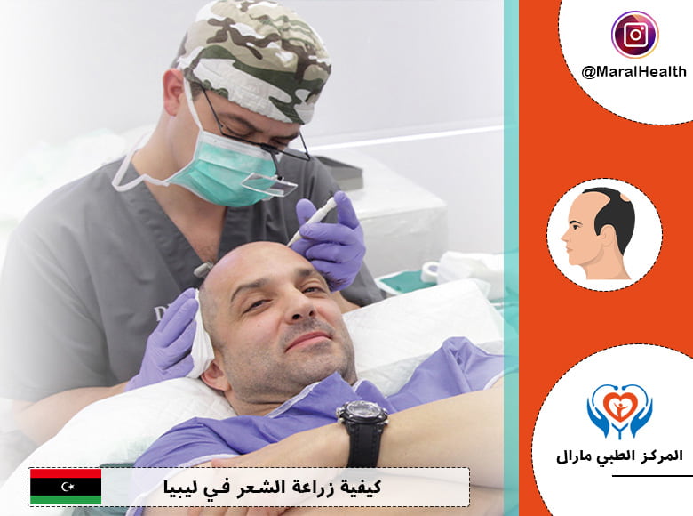 كيفية زراعة الشعر في مركز العناية بالشعر والبشرة فی لیبیا