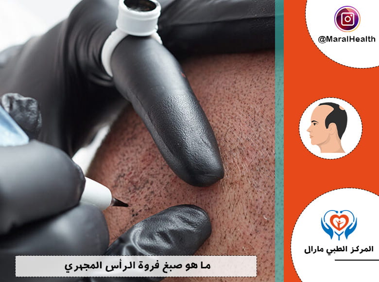 ما هو ال Micropigmentation؟